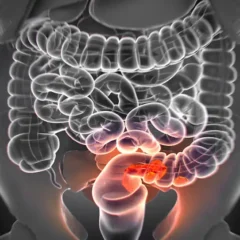 Colorectal Screenings