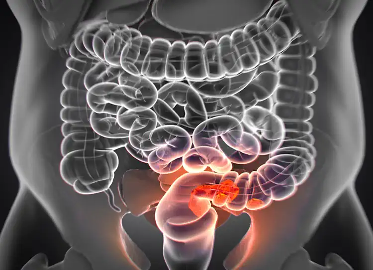 Colorectal Screenings